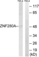 ANTI-ZNF280A ANTIBODY PRODUCED IN RABBIT