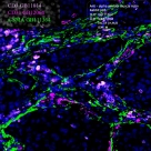 Anti-alpha smooth muscle Actin Rabbit pAb