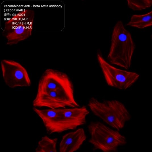 Антитела моноклональные к бета-актину, источник кролик, IgG1, синт. пептид