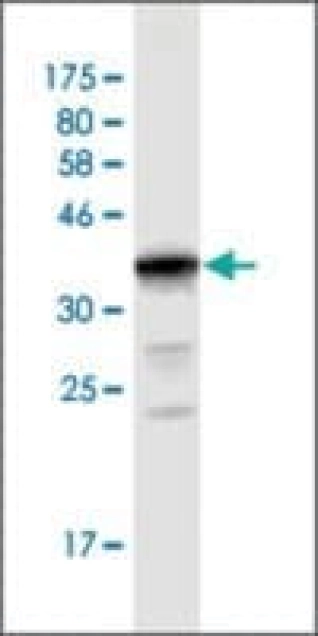 MONOCLONAL ANTI-UGT2B10