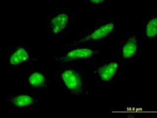 MONOCLONAL ANTI-ZNF396