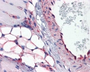 ANTI-CAVIN1 ANTIBODY PRODUCED IN RABBIT