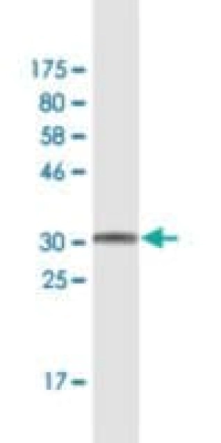 MONOCLONAL ANTI-WFDC3