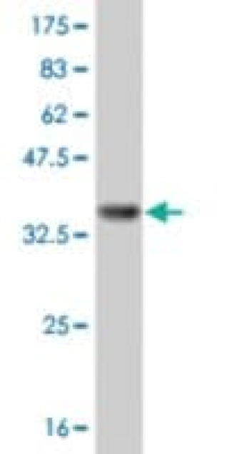 MONOCLONAL ANTI-IL8