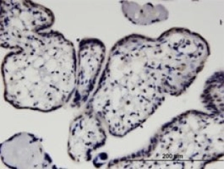 MONOCLONAL ANTI-HEXIM1