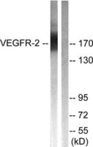 ANTI-VEGFR2 ANTIBODY PRODUCED IN RABBIT