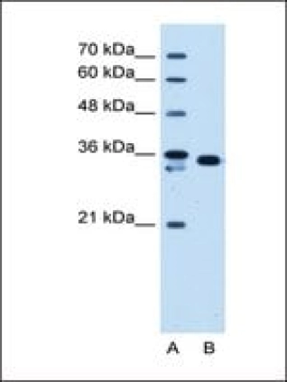 Anti-AKR1B1