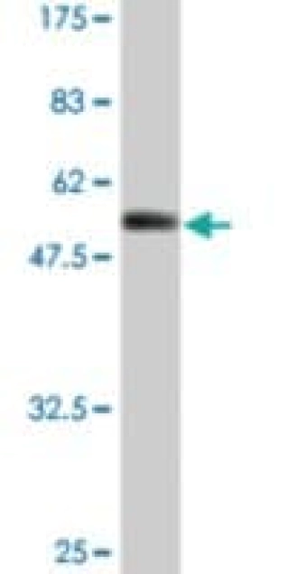 MONOCLONAL ANTI-FCGR3A, (C-TERMINAL)