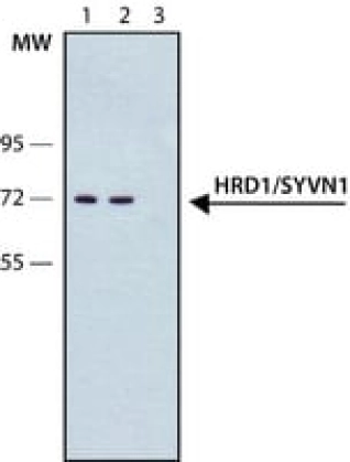 ANTI-HRD1/SYVN1 ANTIBODY, MOUSE MONOCLON