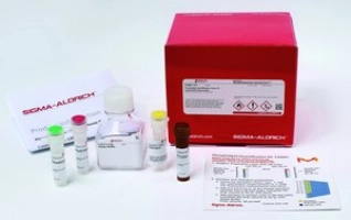 PHOSPHOLIPID QUANTIFICATION ASSAY KIT (C