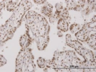 MONOCLONAL ANTI-UBTF