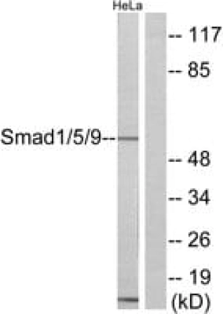 ANTI-SMAD1 ANTIBODY PRODUCED IN RABBIT