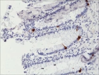 ANTI-CHROMOGRANIN A ANTIBODY, RABBIT MON