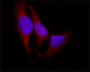 MONOCLONAL ANTI-RNF113B