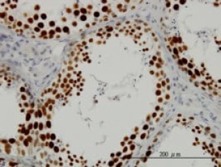 MONOCLONAL ANTI-SFRS14