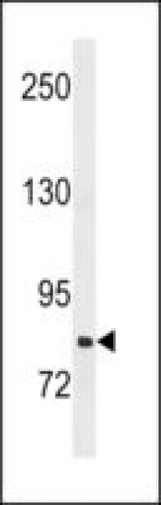 ANTI-SLCO1B3(C-TERMINAL)