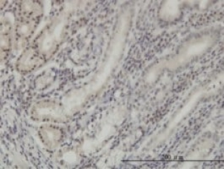 MONOCLONAL ANTI-DLX2