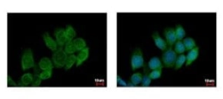 ANTI-ATP6V0A4