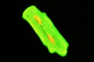 MONOCLONAL ANTI-TROPOMYOSIN, MOUSE     &