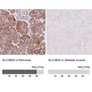ANTI-SLC38A5