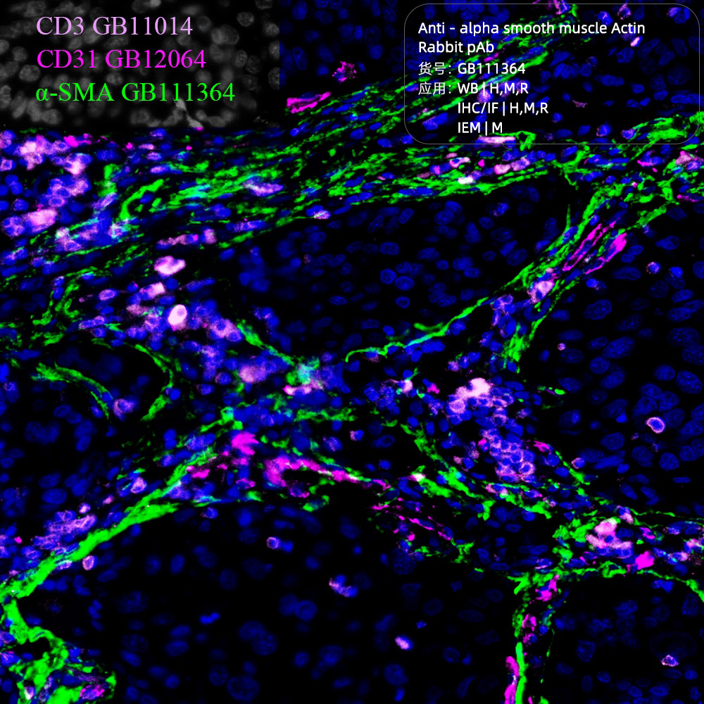 Anti-alpha smooth muscle Actin Rabbit pAb